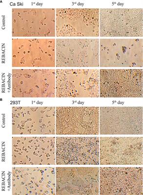 REBACIN® inhibits E6/E7 oncogenes in clearance of human papillomavirus infection